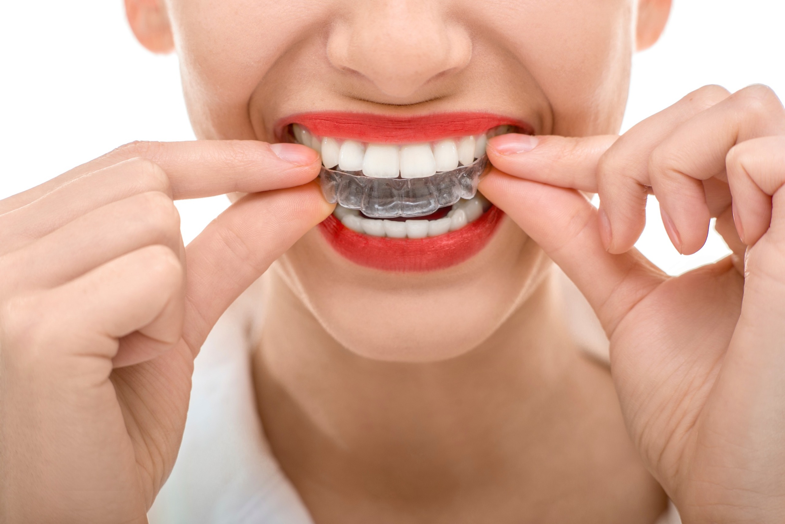 Tips to Make Invisalign Unchallenging